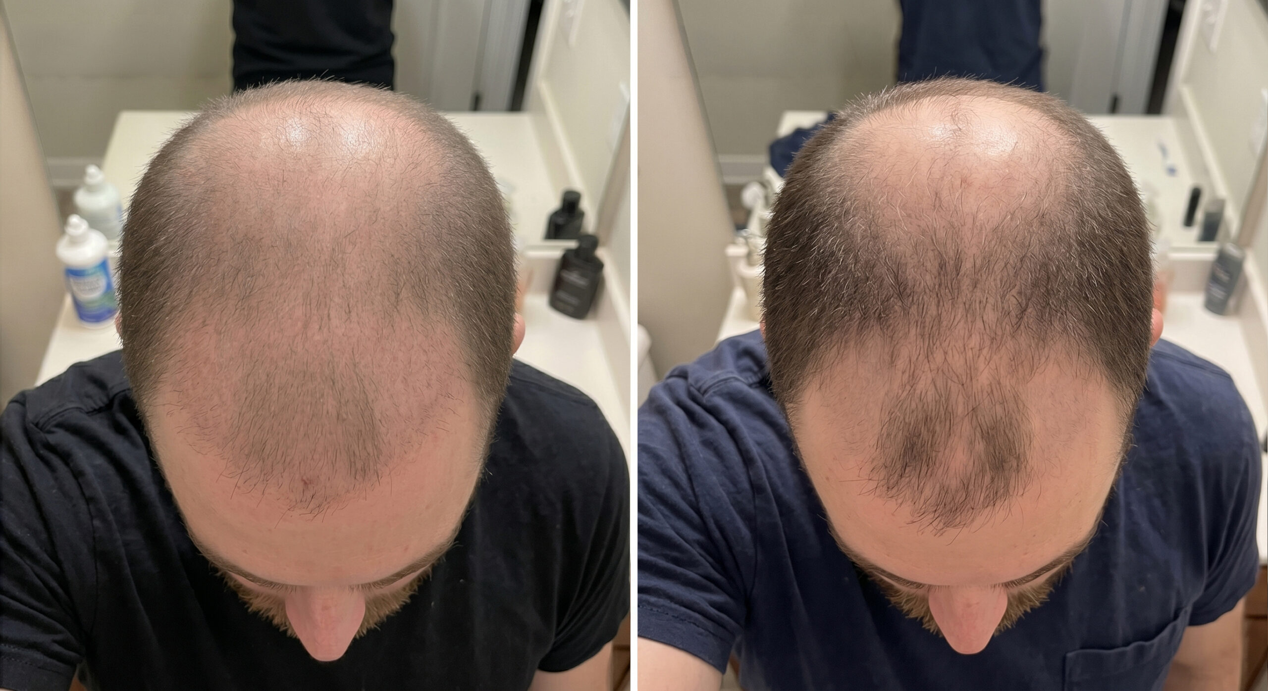 Phase 2